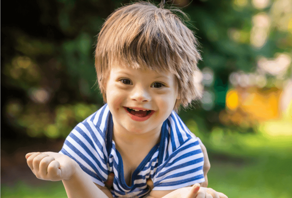 What Makes Down Syndrome Unique Among Genetic Disorders?