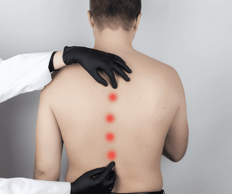 Correcting Scoliosis: When Is Surgery Necessary?