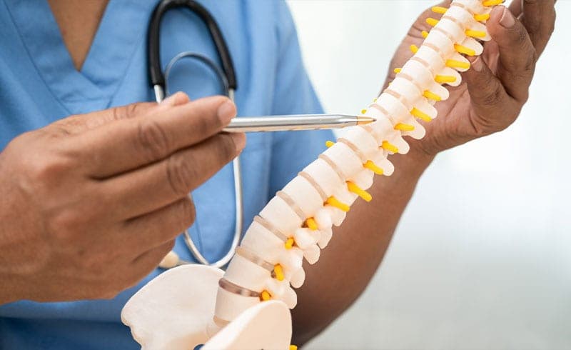 When Is Spinal Fusion Necessary? What Patients Should Know