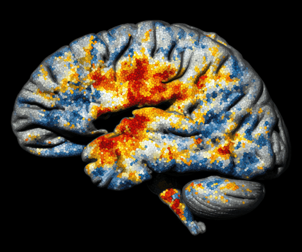 High-Precision Brain Mapping: Protecting Critical Brain Functions During Neurosurgery