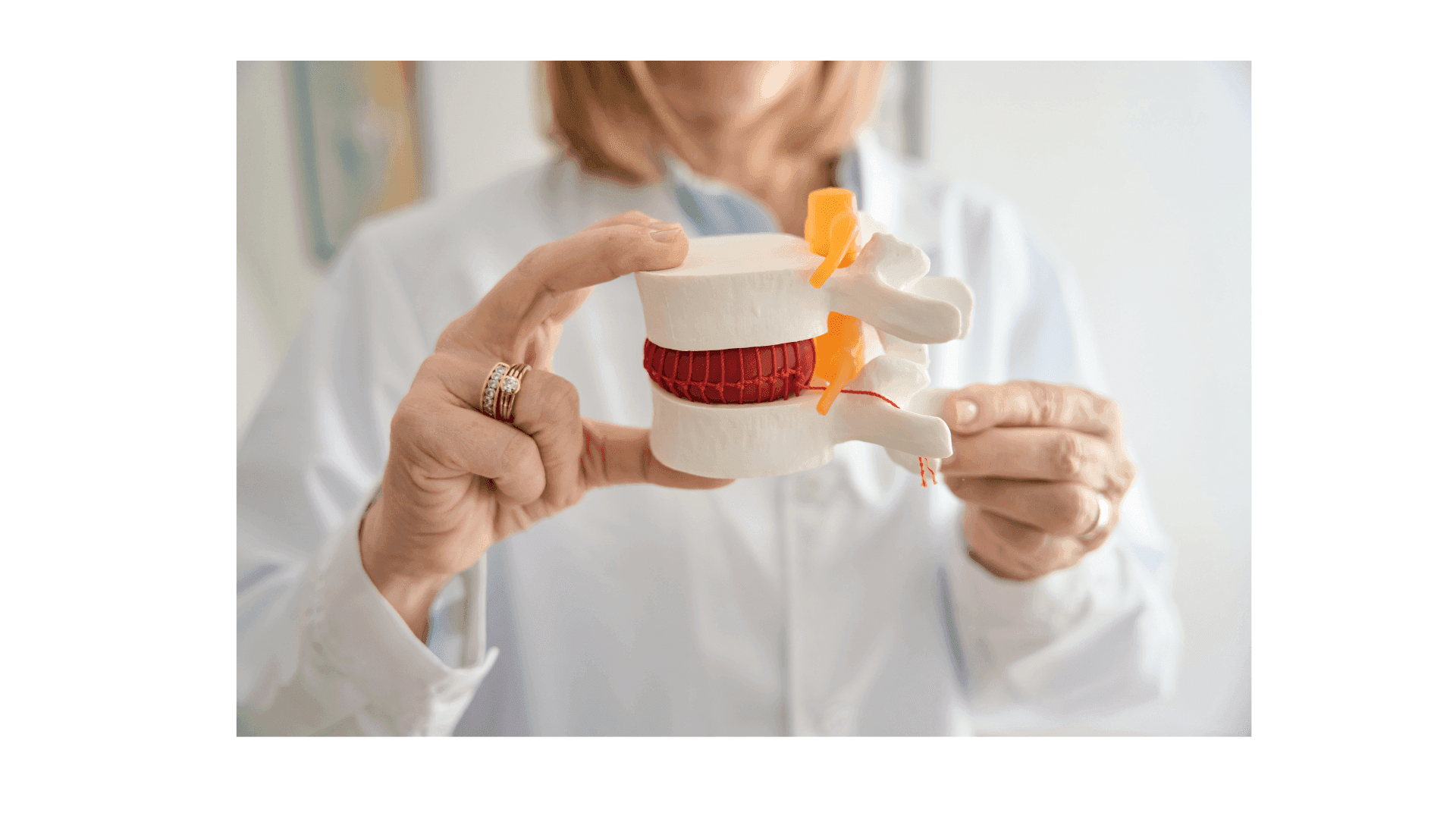 Cervical Disc Herniation: When to Opt for Surgery and When to Continue Conservative Care