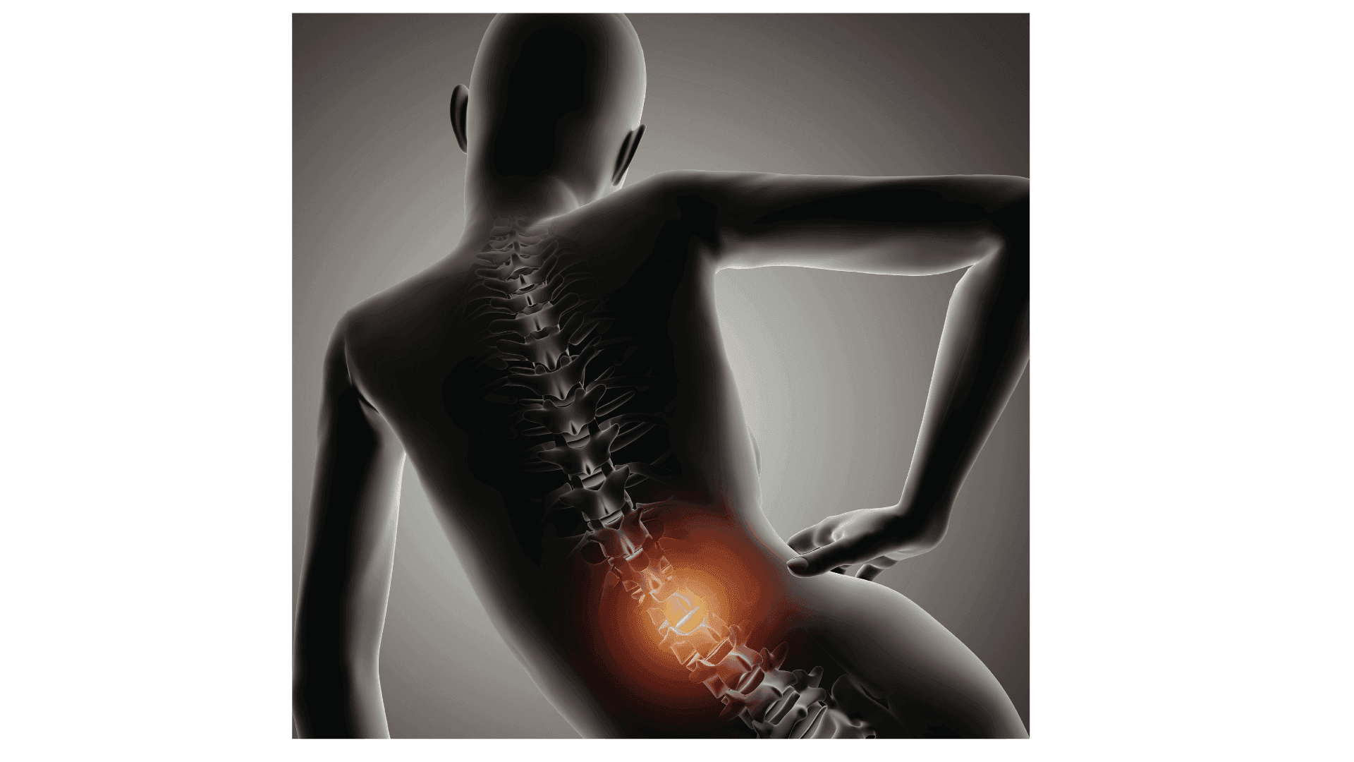 Spinal Tumors and Nerve-Related Symptoms: Understanding the Spine–Brain Connection