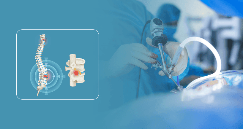 Advances in Spine Surgery: How Modern Techniques are Making Treatment Safer and Faster