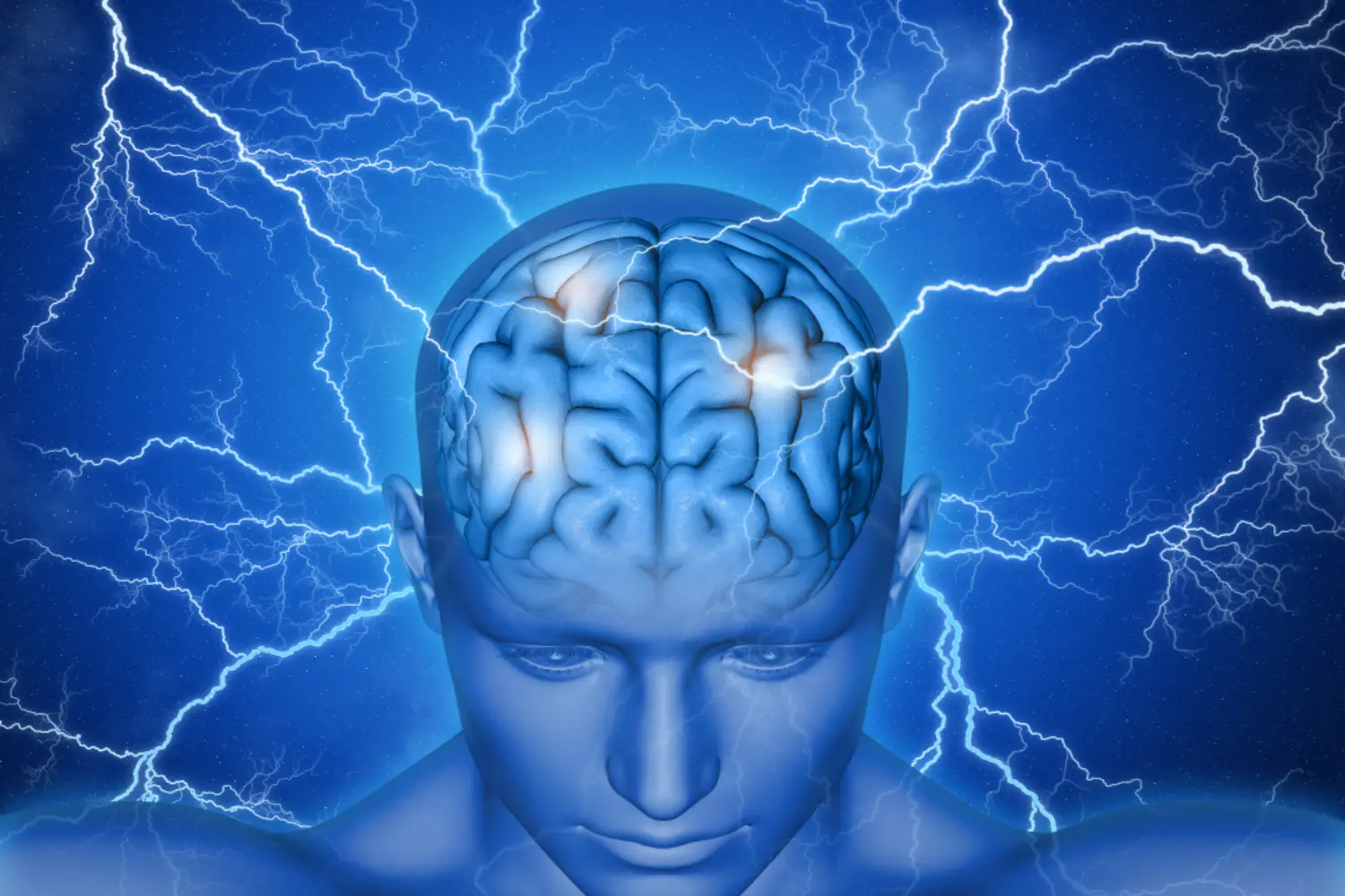 brain stroke