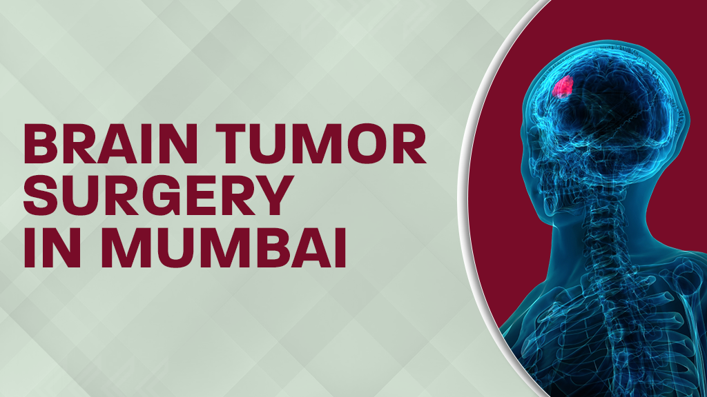 Brain Tumor