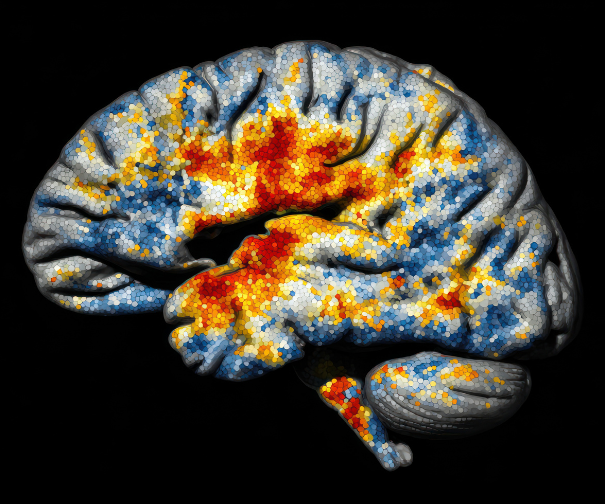 Stroke Paralysis Recovery and Surgery Guide