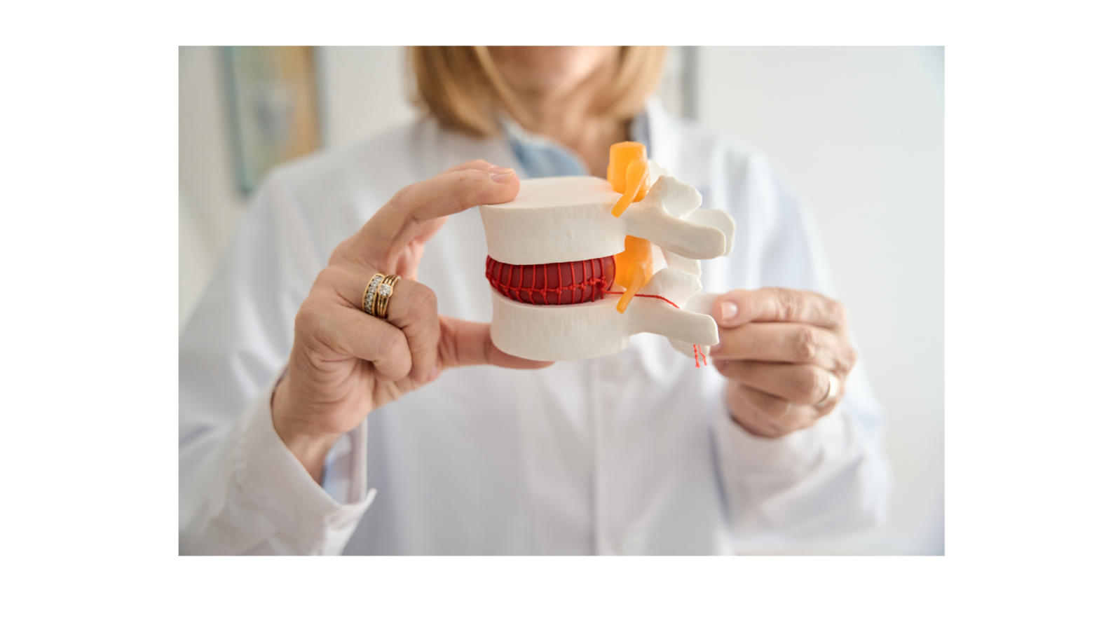 Cervical Disc Herniation: When to Opt for Surgery and When to Continue Conservative Care