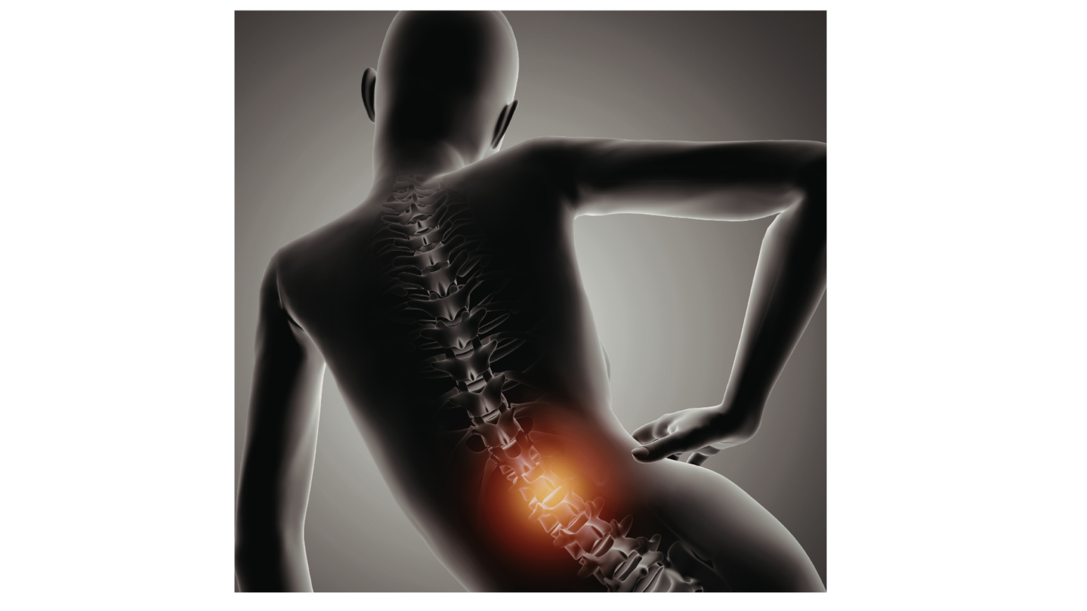 Spinal Tumors and Nerve-Related Symptoms: Understanding the Spine–Brain Connection