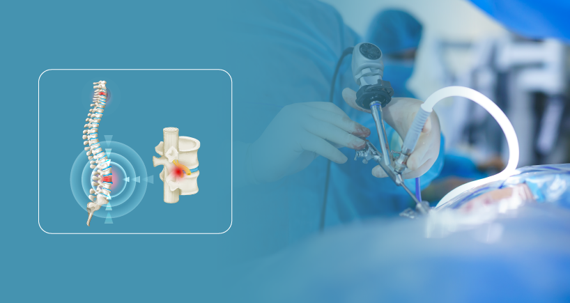 Spine Surgery